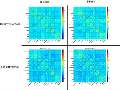 Functional Connectivity of Cognitive Brain Networks in Schizophrenia during a Working Memory Task